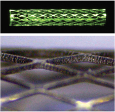 鎳鈦合金微型支架原型的筋寬約為20微米,筋厚為80微米
