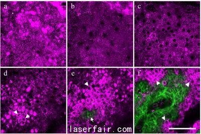利用專門顯微鏡觀察皮膚表層，衡量皮膚細胞中與歲月有關的自然變化程度