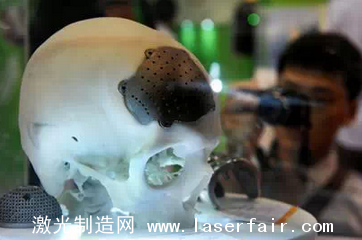 清華x-lab創業團隊AOD斬獲醫療領域千萬級訂單,3D打印應用迎來突破 3D打印機,3D打印技術,3D打印應用,3D沙蟲網