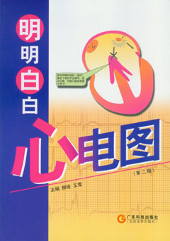 明明白白心電圖