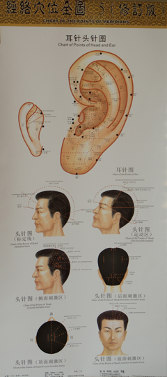 耳針頭針圖
