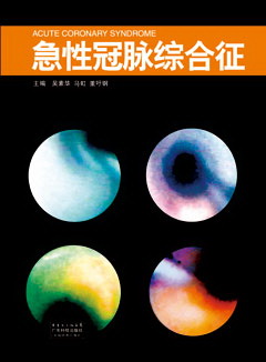 急性冠脈綜合征
