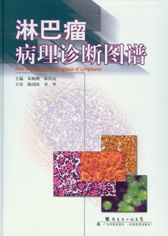 淋巴瘤病理診斷圖譜