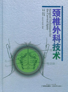 頸椎外科技術(shù)