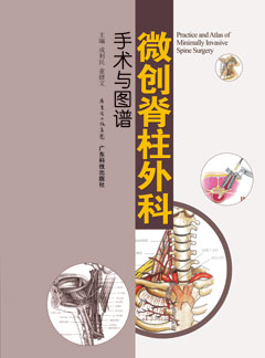 微創(chuàng  )脊柱外科手術(shù)與圖譜