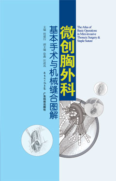 微創(chuàng  )胸外科基本手術(shù)與機械縫合圖解