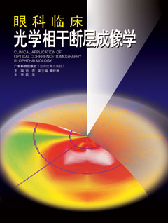 眼科臨床光學(xué)相干斷層成像學(xué)