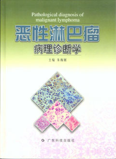 惡性淋巴瘤病理診斷學(xué)