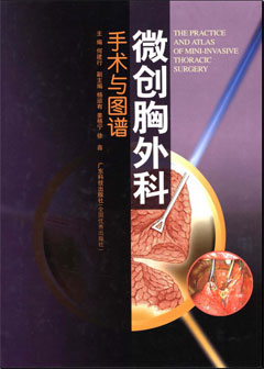 微創(chuàng  )胸外科手術(shù)與圖譜