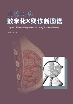 乳腺疾病數字化X線(xiàn)診斷圖譜