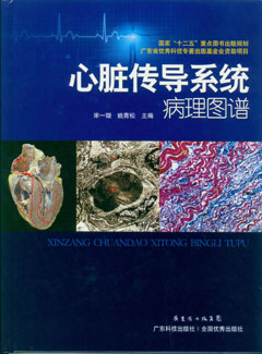 心臟傳導系統病理圖譜