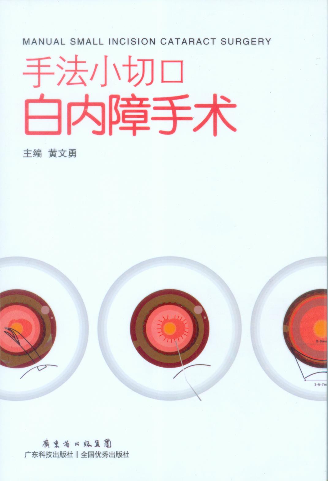 手法小切口白內障手術(shù)