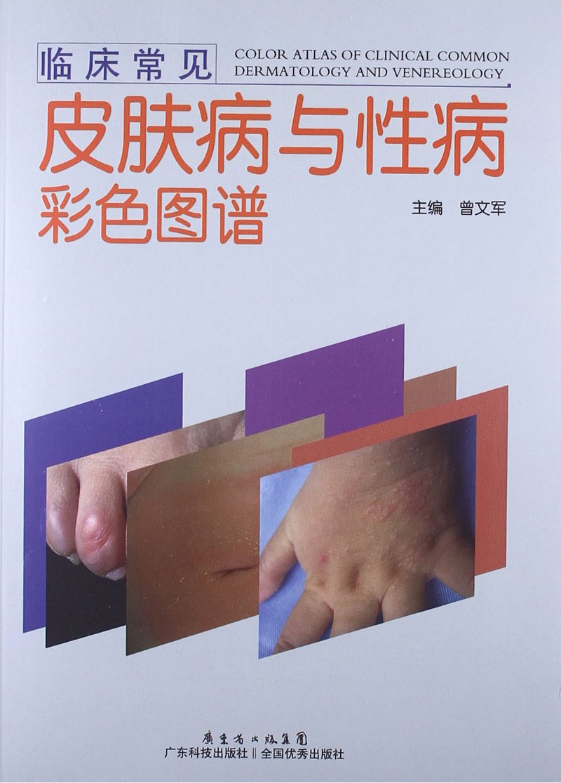 臨床常見(jiàn)皮膚病與性病彩色圖譜