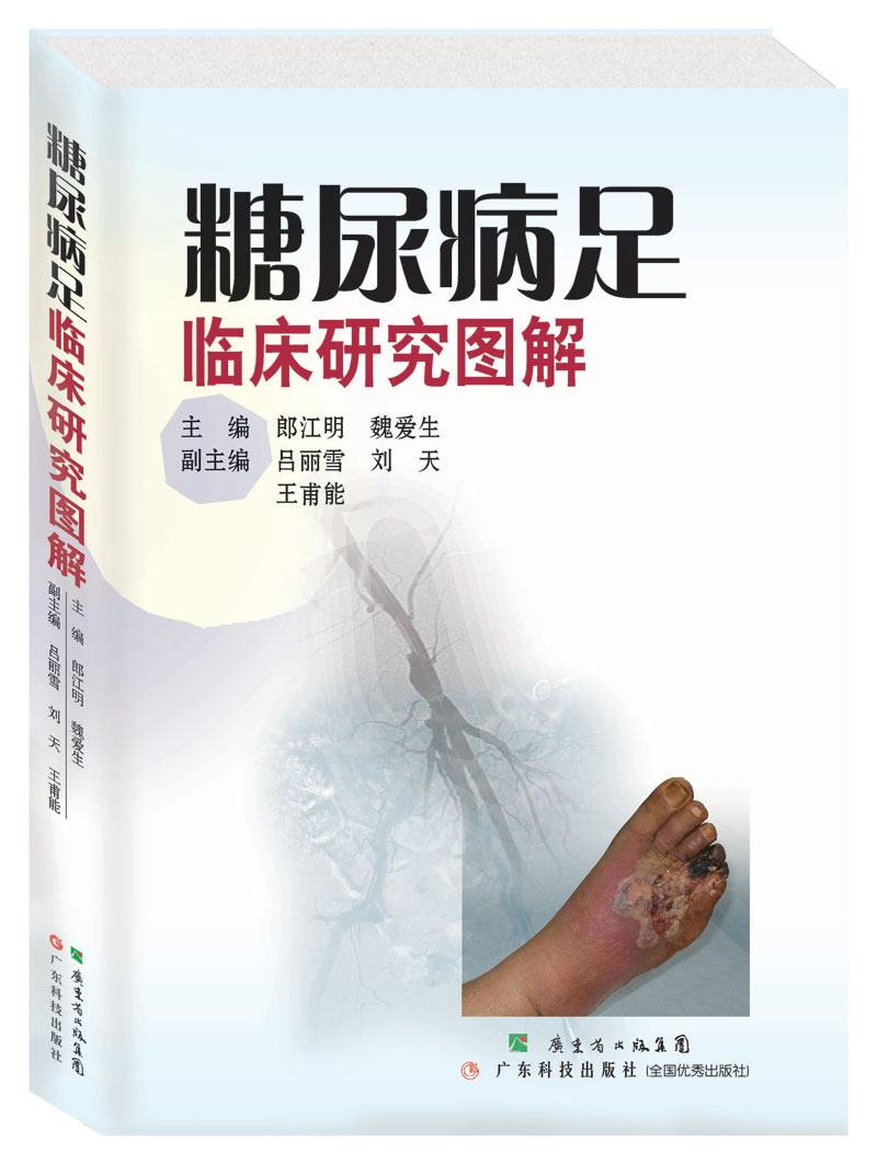 糖尿病足臨床研究圖解