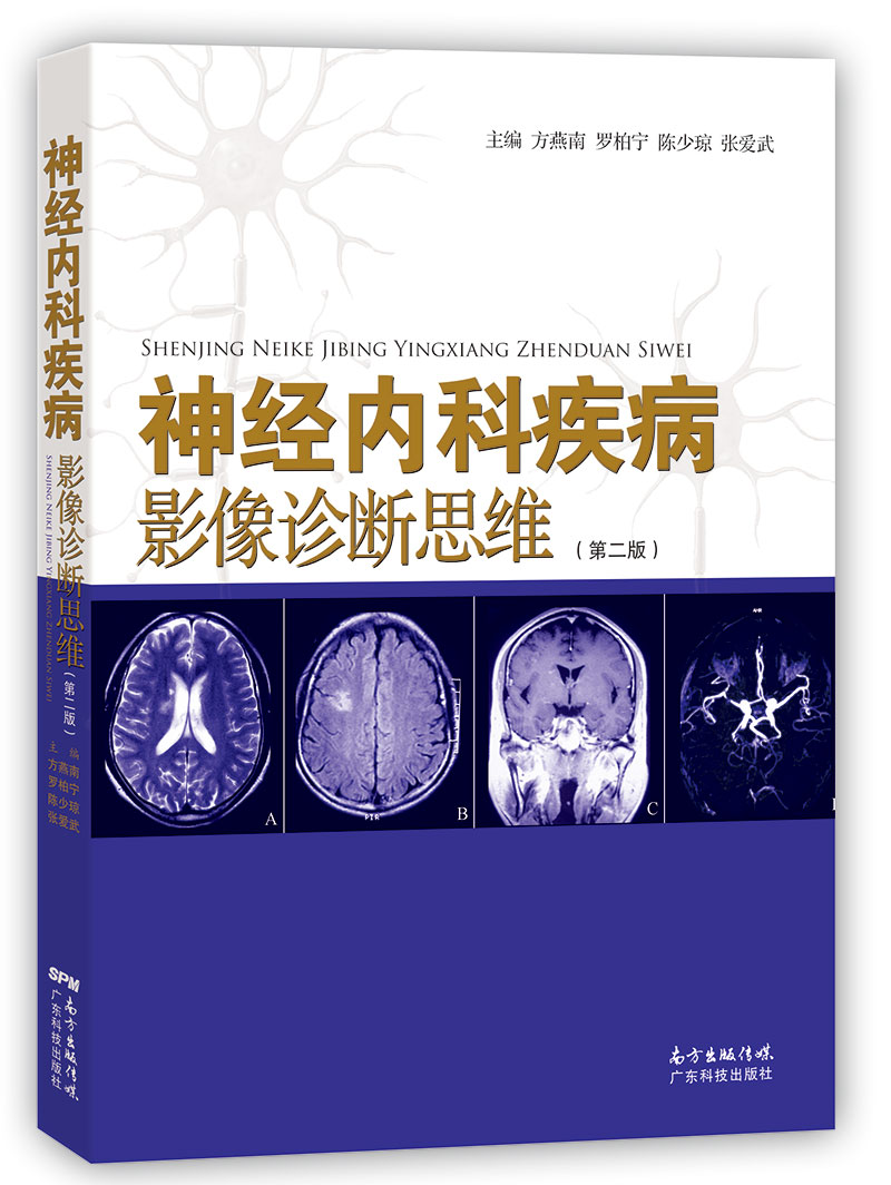 神經(jīng)內科疾病影響診斷思維（第二版）