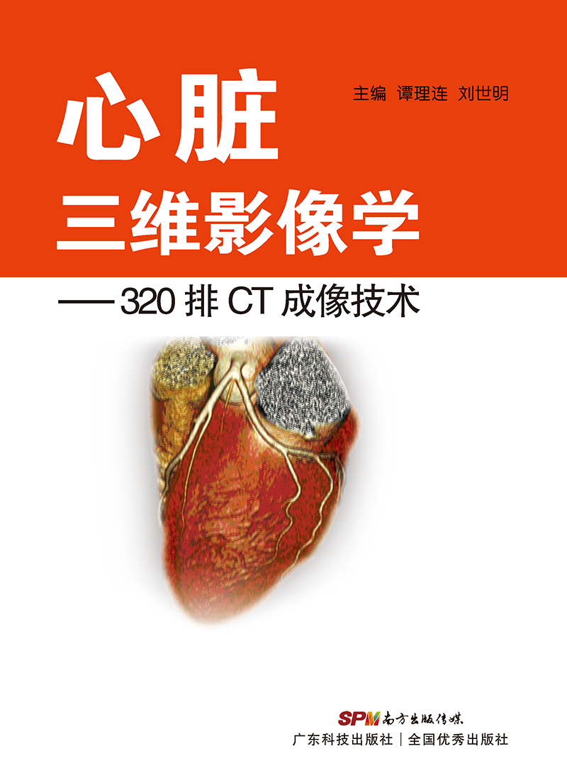 心臟三維影像學(xué)——320排CT成像技術(shù)