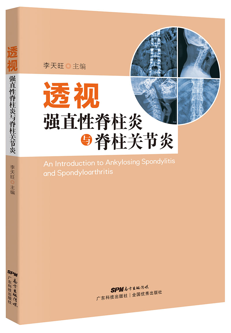 透視強直性脊柱炎與脊柱關(guān)節炎