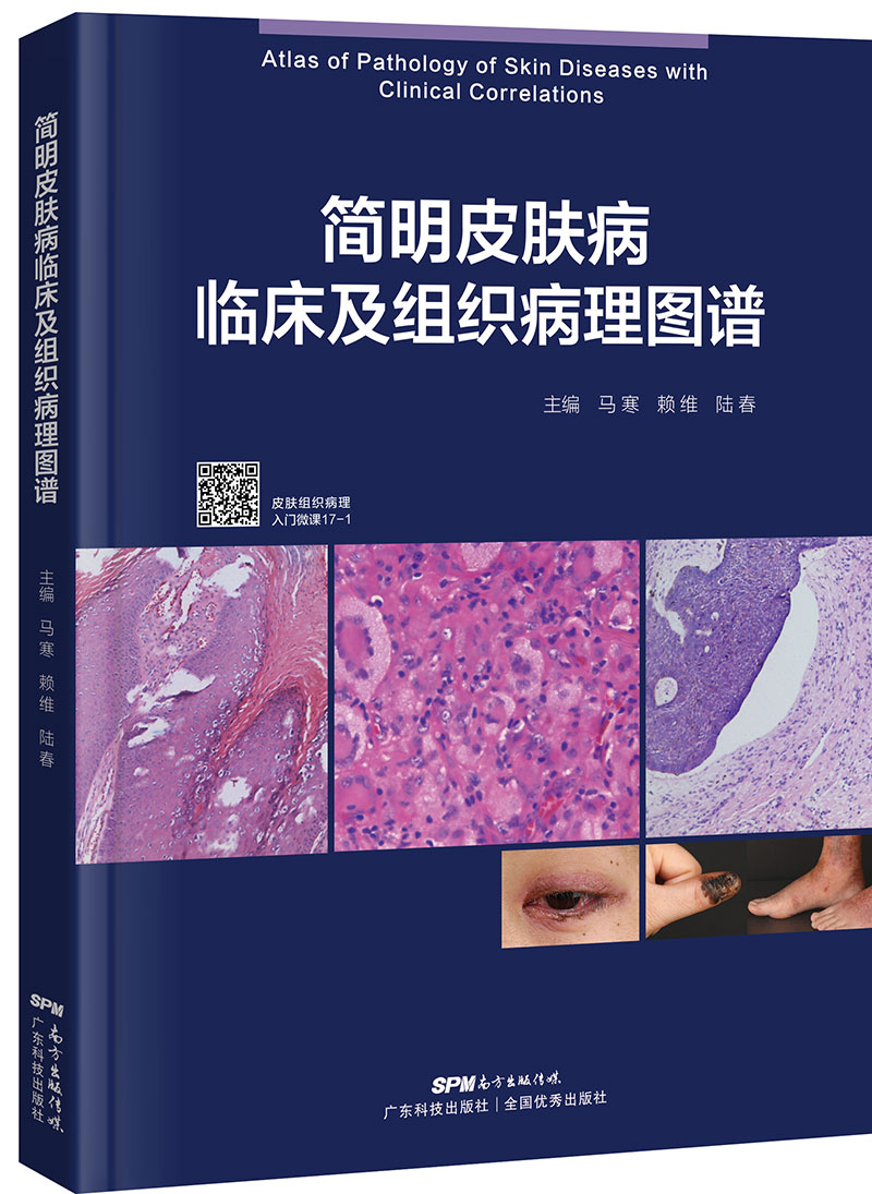 簡(jiǎn)明皮膚病臨床及組織病理圖譜（皮膚科醫生必備工具書(shū)，掃碼看專(zhuān)家現場(chǎng)講解）