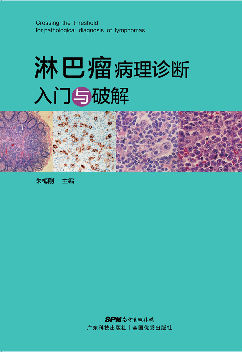 淋巴瘤病理診斷入門(mén)與破解